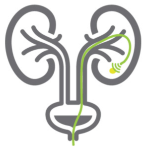 Zabieg RIRS jak wygląda?